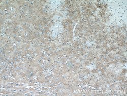 Kir4.1 Rabbit anti-Human, Mouse, Rat, Polyclonal, Proteintech 150 &mu;L;