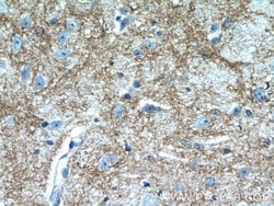 Kir4.1 Rabbit anti-Human, Mouse, Rat, Polyclonal, Proteintech 150 &mu;L;