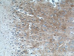 Kir4.1 Rabbit anti-Human, Mouse, Rat, Polyclonal, Proteintech 150 &mu;L;