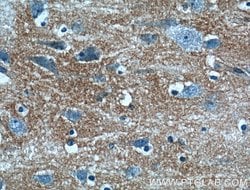 Kir4.1 Rabbit anti-Human, Mouse, Rat, Polyclonal, Proteintech 150 &mu;L;