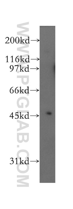 Kir4.1 Rabbit anti-Human, Mouse, Rat, Polyclonal, Proteintech 150 &mu;L;