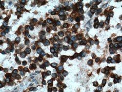 Kir4.1 Rabbit anti-Human, Mouse, Rat, Polyclonal, Proteintech 150 &mu;L;