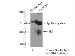 Kir4.1 Rabbit anti-Human, Mouse, Rat, Polyclonal, Proteintech 150 &mu;L;