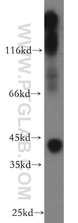 Kir4.1 Rabbit anti-Human, Mouse, Rat, Polyclonal, Proteintech 150 &mu;L;
