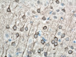AK5 Rabbit anti-Human, Mouse, Rat, Polyclonal, Proteintech:Antibodies:Primary