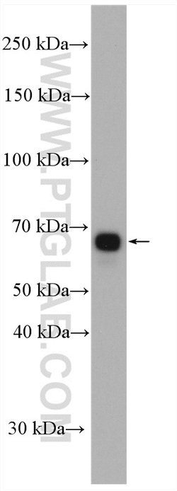 AK5 Rabbit anti-Human, Mouse, Rat, Polyclonal, Proteintech:Antibodies:Primary