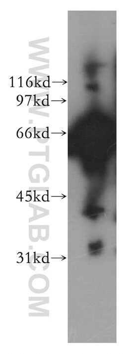 AK5 Rabbit anti-Human, Mouse, Rat, Polyclonal, Proteintech:Antibodies:Primary