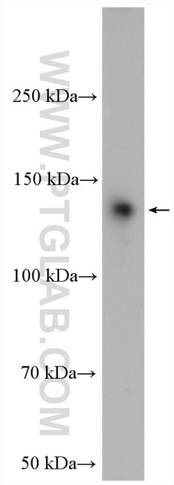SFRS14 Rabbit anti-Human, Mouse, Rat, Polyclonal, Proteintech 150 &mu;L;