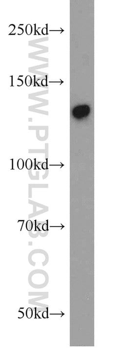 SFRS14 Rabbit anti-Human, Mouse, Rat, Polyclonal, Proteintech 150 &mu;L;