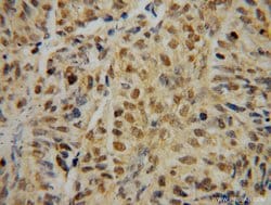IRF2 Rabbit anti-Human, Mouse, Rat, Polyclonal, Proteintech 150 &mu;L;