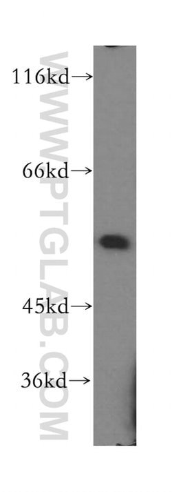 IRF2 Rabbit anti-Human, Mouse, Rat, Polyclonal, Proteintech 150 &mu;L;