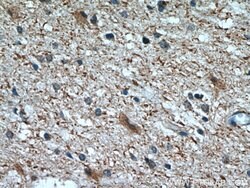 CHMP2B Rabbit anti-Human, Mouse, Rat, Polyclonal, Proteintech:Anticuerpos:Anticuerpos