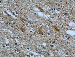 CHMP2B Rabbit anti-Human, Mouse, Rat, Polyclonal, Proteintech:Anticuerpos:Anticuerpos