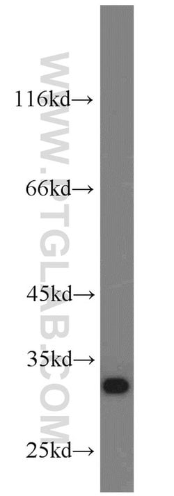 CHMP2B Rabbit anti-Human, Mouse, Rat, Polyclonal, Proteintech:Anticuerpos:Anticuerpos