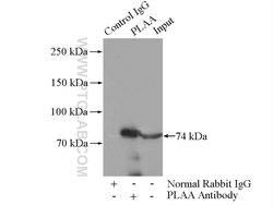 PLAA Rabbit anti-Human, Polyclonal, Proteintech 20 &mu;L | Buy Online | Proteintech | Fisher Scientific