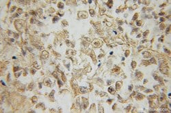 RRAS2 Rabbit anti-Human, Mouse, Polyclonal, Proteintech 150 &mu;L; Unconjugated:Antibodies,
