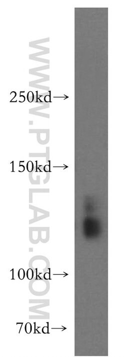 SLC4A8 Rabbit anti-Human, Mouse, Rat, Polyclonal, Proteintech:Antibodies:Primary