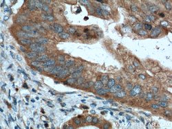 Amylase alpha Rabbit anti-Human, Mouse, Rat, Polyclonal, Proteintech:Antibodies:Primary
