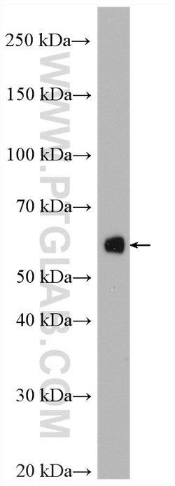 Amylase alpha Rabbit anti-Human, Mouse, Rat, Polyclonal, Proteintech:Antibodies:Primary