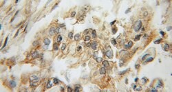Amylase alpha Rabbit anti-Human, Mouse, Rat, Polyclonal, Proteintech:Antibodies:Primary