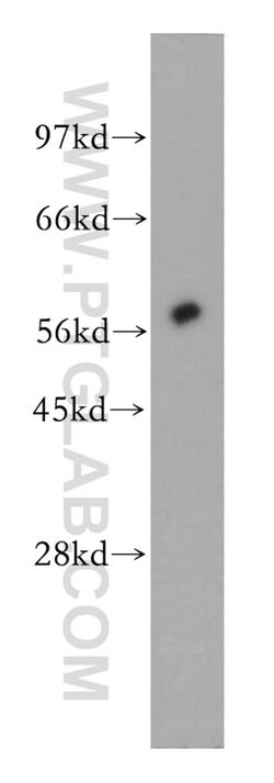 Amylase alpha Rabbit anti-Human, Mouse, Rat, Polyclonal, Proteintech:Antibodies:Primary