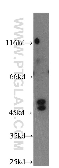 TRIM31 Rabbit anti-Human, Polyclonal, Proteintech 150 &mu;L; Unconjugated:Antibodies,