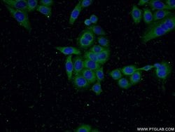 SQLE Rabbit anti-Human, Mouse, Rat, Polyclonal, Proteintech:Antibodies:Primary