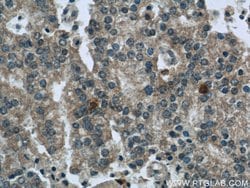 SQLE Rabbit anti-Human, Mouse, Rat, Polyclonal, Proteintech:Antibodies:Primary