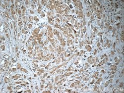 SQLE Rabbit anti-Human, Mouse, Rat, Polyclonal, Proteintech:Antibodies:Primary