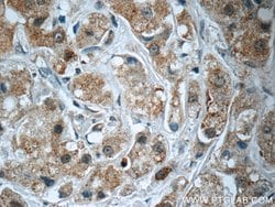 SQLE Rabbit anti-Human, Mouse, Rat, Polyclonal, Proteintech:Antibodies:Primary