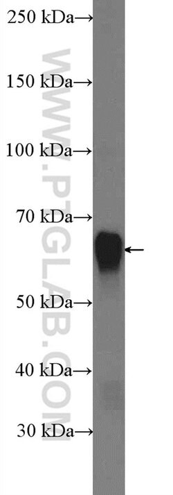 SQLE Rabbit anti-Human, Mouse, Rat, Polyclonal, Proteintech:Antibodies:Primary