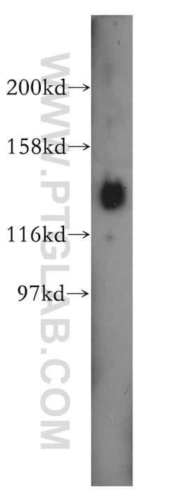 PER3 Rabbit anti-Human, Mouse, Rat, Polyclonal, Proteintech 150 μL;