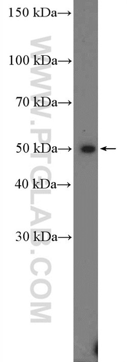 PRMT8 Rabbit anti-Human, Mouse, Rat, Polyclonal, Proteintech:Antibodies:Primary