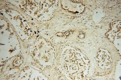 STK36 Rabbit anti-Human, Mouse, Rat, Polyclonal, Proteintech:Antibodies:Primary