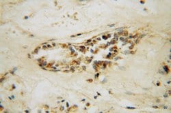 STK36 Rabbit anti-Human, Mouse, Rat, Polyclonal, Proteintech:Antibodies:Primary