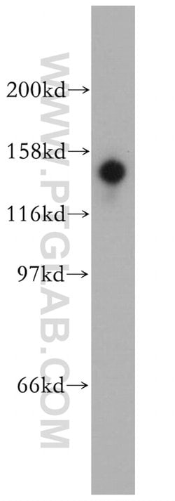 STK36 Rabbit anti-Human, Mouse, Rat, Polyclonal, Proteintech:Antibodies:Primary