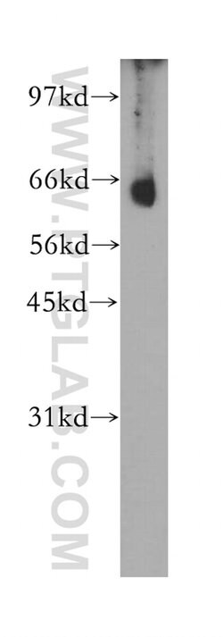 CNOT4 Rabbit anti-Human, Mouse, Rat, Polyclonal, Proteintech 150 &mu;L | Buy Online | Proteintech Group Inc | Fisher Scientific