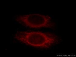 SMAD2 Rabbit anti-Human, Mouse, Rat, Polyclonal, Proteintech:Antibodies:Primary