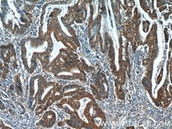 SMAD2 Rabbit anti-Human, Mouse, Rat, Polyclonal, Proteintech:Antibodies:Primary