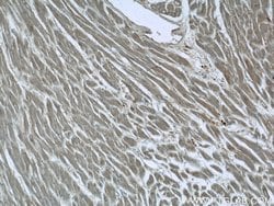 SMAD2 Rabbit anti-Human, Mouse, Rat, Polyclonal, Proteintech:Antibodies:Primary