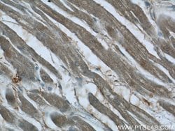 SMAD2 Rabbit anti-Human, Mouse, Rat, Polyclonal, Proteintech:Antibodies:Primary