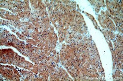 SMAD2 Rabbit anti-Human, Mouse, Rat, Polyclonal, Proteintech:Antibodies:Primary