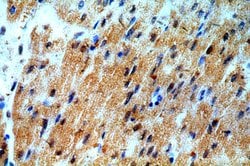 SMAD2 Rabbit anti-Human, Mouse, Rat, Polyclonal, Proteintech:Antibodies:Primary
