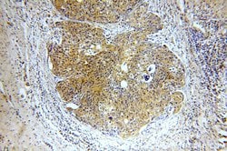 SMAD2 Rabbit anti-Human, Mouse, Rat, Polyclonal, Proteintech:Antibodies:Primary