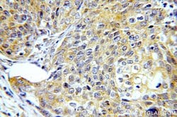 SMAD2 Rabbit anti-Human, Mouse, Rat, Polyclonal, Proteintech:Antibodies:Primary