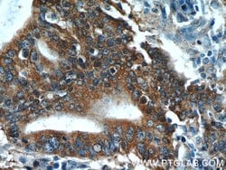 SMAD2 Rabbit anti-Human, Mouse, Rat, Polyclonal, Proteintech:Antibodies:Primary