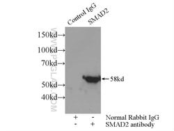 SMAD2 Rabbit anti-Human, Mouse, Rat, Polyclonal, Proteintech:Antibodies:Primary