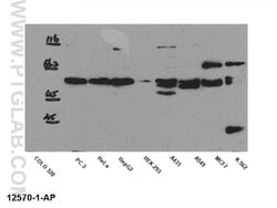 SMAD2 Rabbit anti-Human, Mouse, Rat, Polyclonal, Proteintech:Antibodies:Primary
