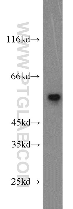 SMAD2 Rabbit anti-Human, Mouse, Rat, Polyclonal, Proteintech:Antibodies:Primary