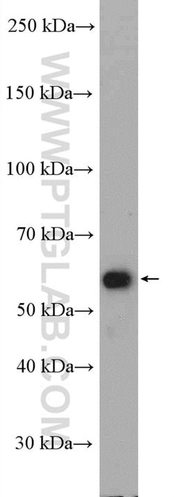 SMAD2 Rabbit anti-Human, Mouse, Rat, Polyclonal, Proteintech:Antibodies:Primary